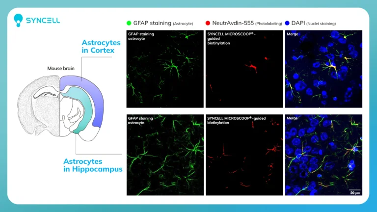 Dataset - Neuroscience - Astrocyte PL