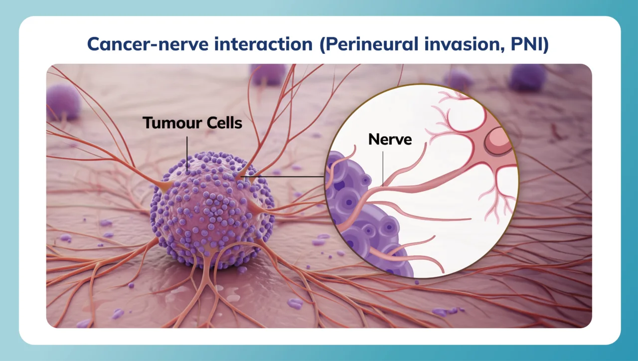 Cancer-Nerve-interactive-02