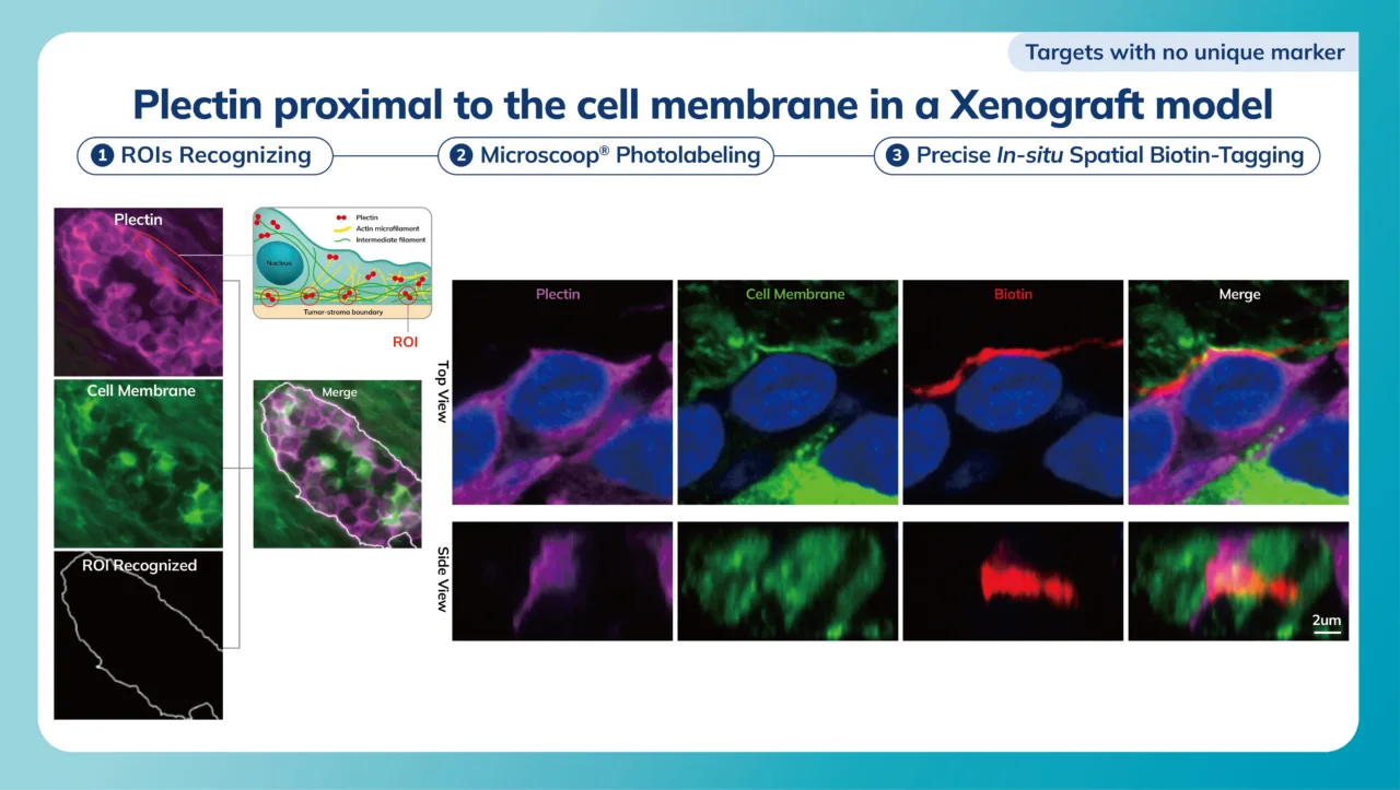 Plectin proximal to the cell membrane in a Xenograft model