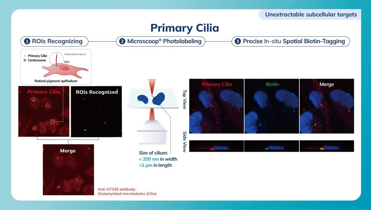 Primary Cilia_20260316
