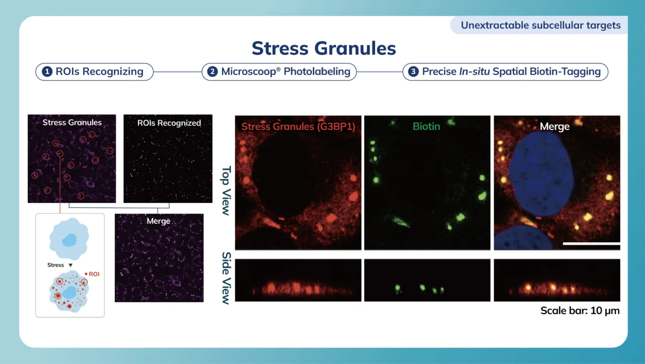 Stress Granules