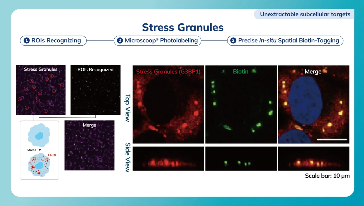 Stress Granules